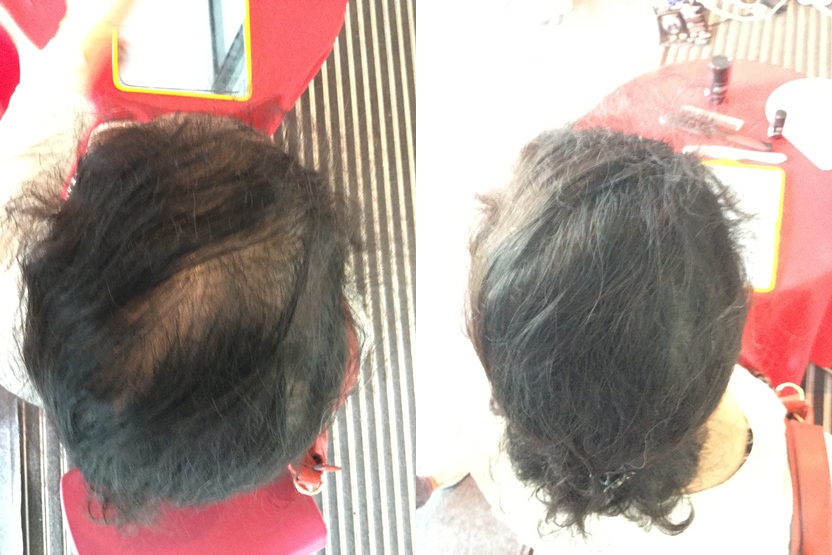 A local women use toppik instant hair replacement service in malaysia